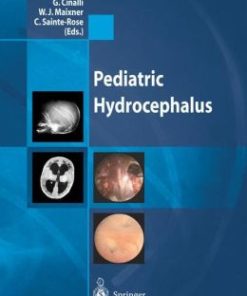 Pediatric Hydrocephalus (PDF)