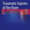 Traumatic Injuries of the Knee (EPUB)