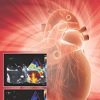Manual Of Cardiac Diagnosis (PDF)