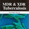 MDR & XDR Tuberculosis (PDF)