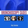 Bronchoscopy Cases (PDF)