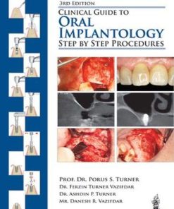 Clinical Guide to Oral Implantology: Step by Step Procedures, 3rd Edition (PDF Book)