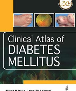 Clinical Atlas of Diabetes Mellitus (PDF)