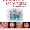 Endoscopic Ear Surgery a New Horizon (PDF)