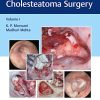 Atlas of Cavityless Cholesteatoma Surgery (Volume 1) (PDF)