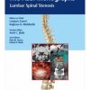The ASSI Monographs: Lumbar Spinal Stenosis (PDF)