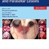 Atlas of Sellar, Suprasellar, and Parasellar Lesions (PDF Book+Videos)