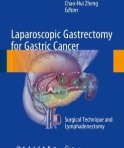 Laparoscopic Gastrectomy for Gastric Cancer: Surgical Technique and Lymphadenectomy (EPUB)
