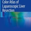 Color Atlas of Laparoscopic Liver Resection (PDF)