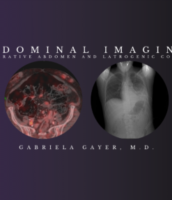 Abdominal Imaging – Gabriela Gayer, M.D. (CMEScience) (CME Videos)