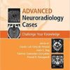 Advanced Neuroradiology Cases: Challenge Your Knowledge