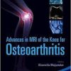 Advances in MRI of the Knee for Osteoarthritis