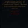 Angiocardiograms in Congenital Heart Disease (Oxford Medical Publications) (High Quality Scanned PDF)