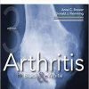 Arthritis in Black and White: Expert Consult – Online and Print, 3e