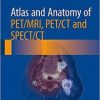 Atlas and Anatomy of PET/MRI, PET/CT and SPECT/CT 1st ed. 2016