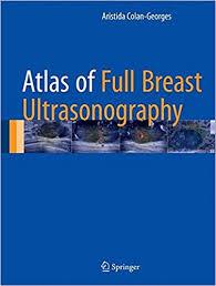 Atlas of Full Breast Ultrasonography 1st ed. 2016