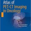 Atlas of PET-CT Imaging in Oncology: A Case-Based Guide to Image Interpretation