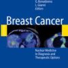 Breast Cancer: Nuclear Medicine in Diagnosis and Therapeutic Options 2008th Edition