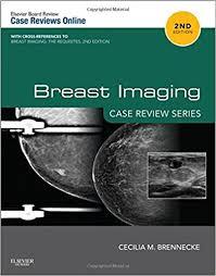 Breast Imaging: Case Review Series, 2e