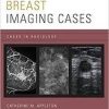 Breast Imaging Cases (Cases in Radiology)