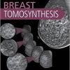 Breast Tomosynthesis, 1e