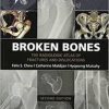 Broken Bones : The Radiologic Atlas of Fractures and Dislocations, 2nd Edition