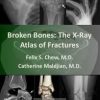 Broken Bones: The X-Ray Atlas of Fractures
