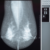 Comprehensive Review of Breast Imaging 2022 (CME VIDEOS)