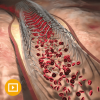 Comprehensive Review of Interventional Cardiology 2023 (CME VIDEOS)