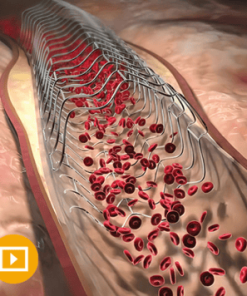 Comprehensive Review of Interventional Cardiology 2023 (CME VIDEOS)