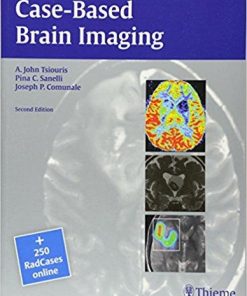 Case-Based Brain Imaging (RadCases) 2nd Edition