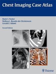 Chest Imaging Case Atlas 2nd Edition