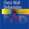 Chest Wall Deformities 1st ed. 2017 Edition