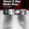 Chest X-Ray Made Easy, 4e