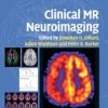 Clinical MR Neuroimaging: Physiological and Functional Techniques, 2nd Edition