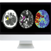 Code Stroke: What Every Radiologist Should Know 2022