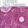 Common Skin Diseases 18th