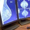 Comprehensive Review of Breast Imaging (5 in 1) 2013 (CME Videos)