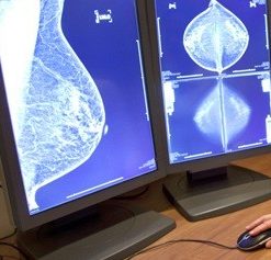 Comprehensive Review of Breast Imaging (5 in 1) 2013 (CME Videos)