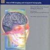 Cranial Neuroimaging and Clinical Neuroanatomy: Magnetic Resonance Imaging andComputed Tomography