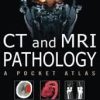 CT & MRI Pathology: A Pocket Atlas, Second Edition 2nd Edition