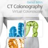 CT Colonography, Virtual Colonoscopy