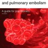 Deep Vein Thrombosis and Pulmonary Embolism: A Guide for Practitioners, 2e