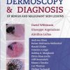 Dermoscopy and Diagnosis of Benign and Malignant Skin Lesions (EPUB)