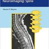 Differential Diagnosis in Neuroimaging: Spine 1st Edition