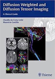 Diffusion Weighted and Diffusion Tensor Imaging: A Clinical Guide 1st Edition