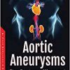Aortic Aneurysms: Signs, Symptoms and Management (PDF)