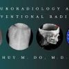 Neuroradiology and Interventional Radiology 2020 (CME VIDEOS)