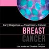 Early Diagnosis and Treatment of Cancer Series: Breast Cancer: Expert Consult – Online and Print, 1e (Early Diagnosis in Cancer)
