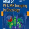 EBOOK Atlas of PET/MR Imaging in Oncology